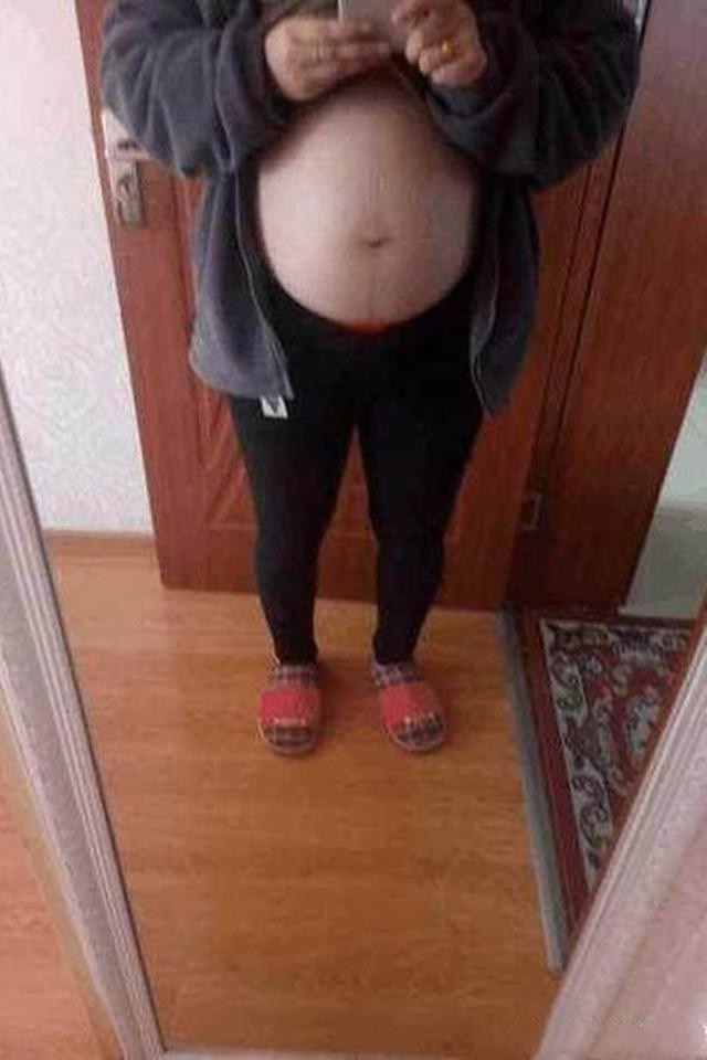 超级宝妈|孕妇“悬浮肚”是咋回事？跟多胞胎关系不大，可能是“头盆不称”