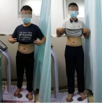 肥胖|12岁就脂肪肝、肝纤维化！这个问题要注意