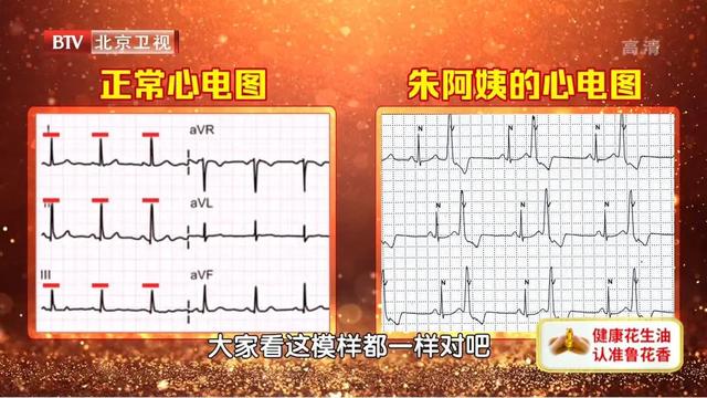 心跳过慢、过快、乱跳，都是因为它出了问题！赶紧摸脉自测一下