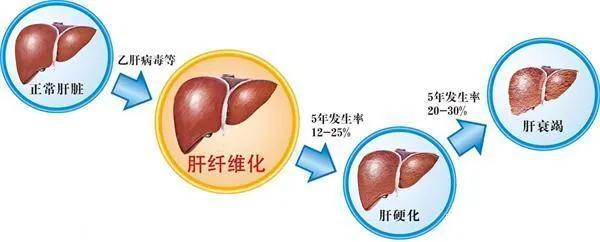 新冠战“疫”中大放异彩的人工肝系统，到底是什么样的？