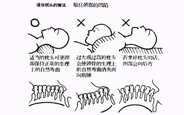 失眠多梦易醒，很可能是颈椎在报警