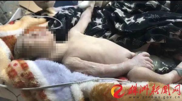 「你的育儿经」二胎妈妈提前临盆 将34周婴儿生在了家中厕所
