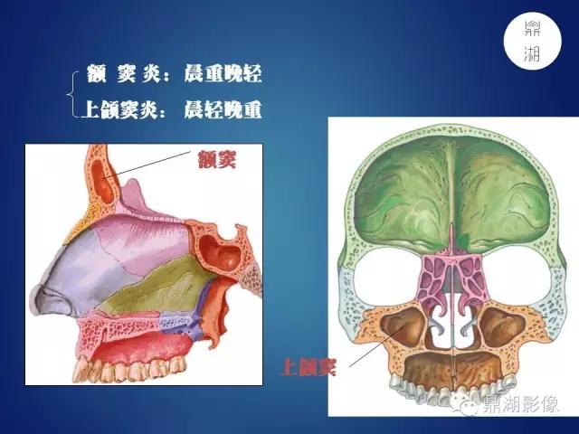 WoW，最全神经系统解剖图来了