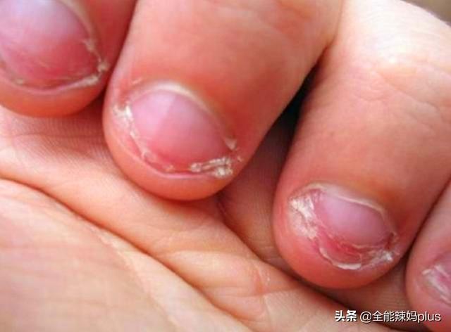 你的育儿经：从小爱啃手指的孩子，长大难逃这3种结局，你家孩子中了吗？