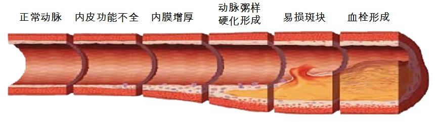 提醒：腿上出现这个东西，要小心了