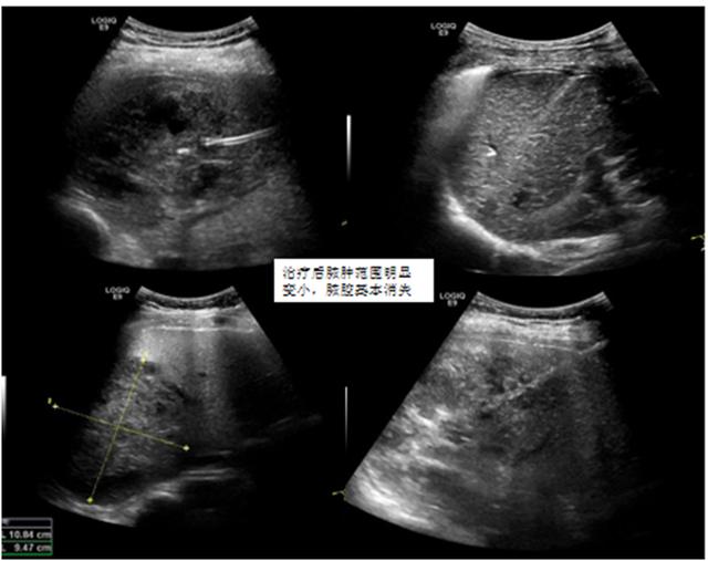 高热！休克！滨医烟台附院导航式服务助其转危为安