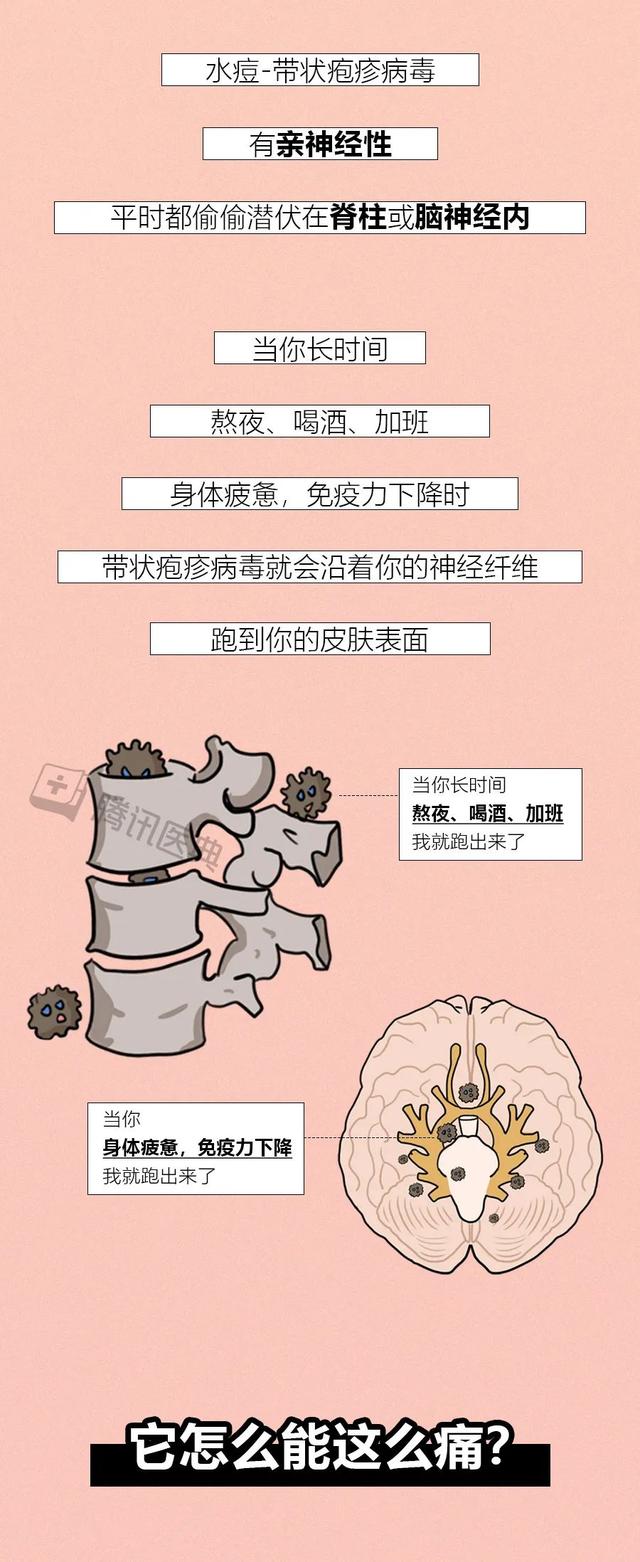 总是熬夜、喝酒，小心这个病毒找上门，疼起来真要命