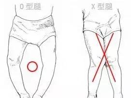 超级宝妈▲O型腿、X腿什么的可真是太烦了，宝宝可千万不要这样啊！