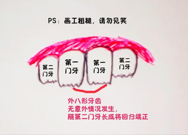 [超级宝妈]涨知识，原来孩子的牙齿是这样长的