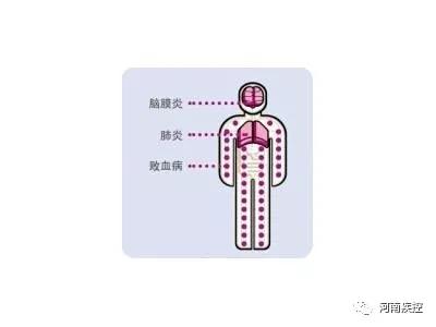 你的育儿经|肺炎疫苗接种全攻略