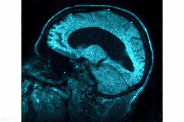 小儿脑积水高发？防治脑积水的6个好方法，做好预防工作是关键