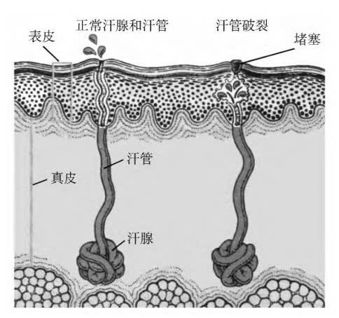 「超级宝妈」爽身粉致癌吗?为了不伤害宝宝,一定要分清楚痱子粉与爽身粉