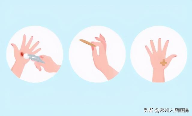 就是这个小东西，差点要命