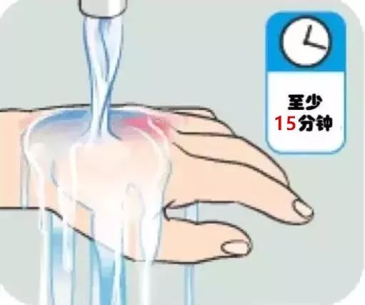 暖先生格调■可怕!20分钟眼球被溶化!8岁男孩终生失明!家家都有这东西