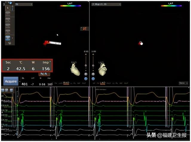 心脏|龙岩5岁女童心跳似打鼓，但一检查就恢复正常心跳！专家：这些异常状况家长需引起重视