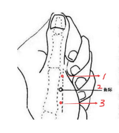 古法取穴——寻象取脉