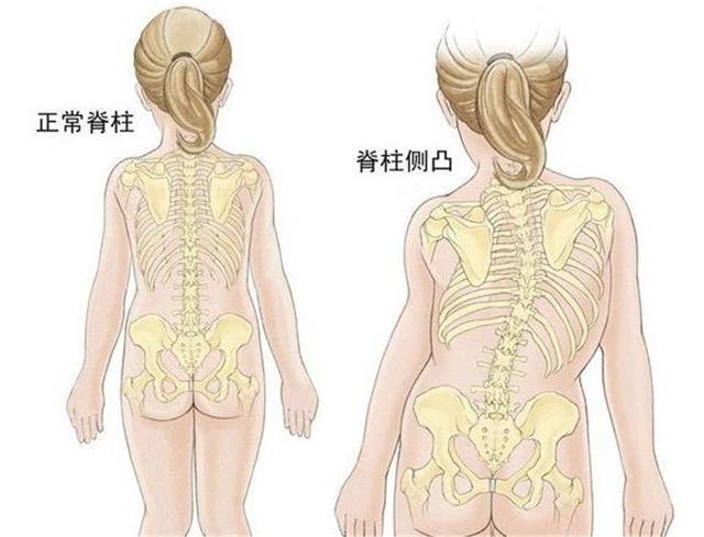 让宝宝越坐越“矮”的2种坐姿，基因再好也白搭，希望你娃没有