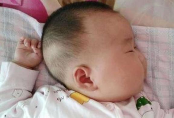 超级宝妈|3岁男孩成面瘫，医生：夏日带娃，父母别做这3件事，会坑了孩子