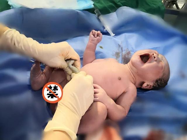 超级宝妈|顺产不打无痛是一种什么样的体验？！
