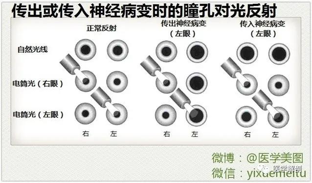 WoW，最全神经系统解剖图来了