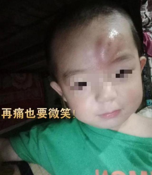 你的育儿经▲宝爸带娃翻车现场,“铁手指”给儿子脑门弹个包,宝爸:可咋交代