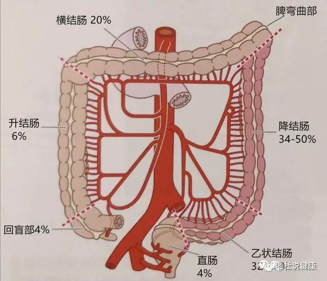 老年人突然腹痛，要小心死亡率很高的——“缺血性肠病”