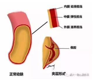 [你的育儿经]高龄产妇突发胸痛，竟是胎儿隔壁有“炸弹”，生死时速，挽救两条生命