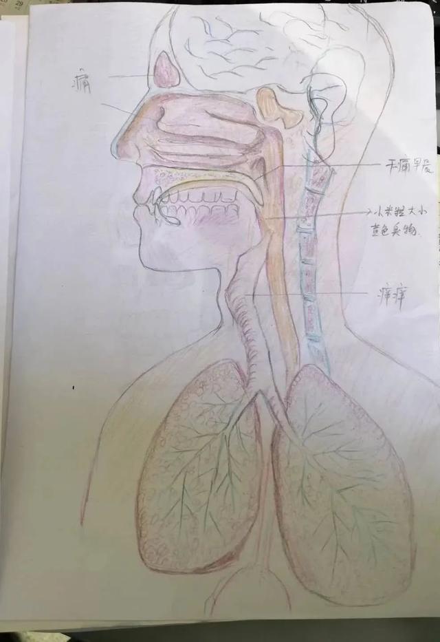 患者自画“CT片子”就诊，医生直呼太专业！症状描述简单准确