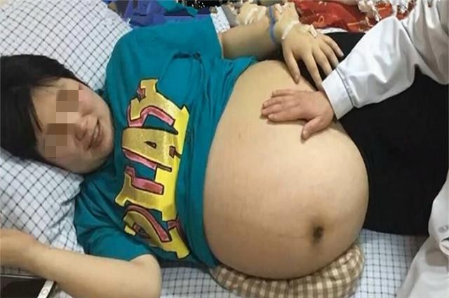 亲本佳人|孕妈怀上3胞胎，3个娃从孕16周生到孕30周，分3次才陆续生完