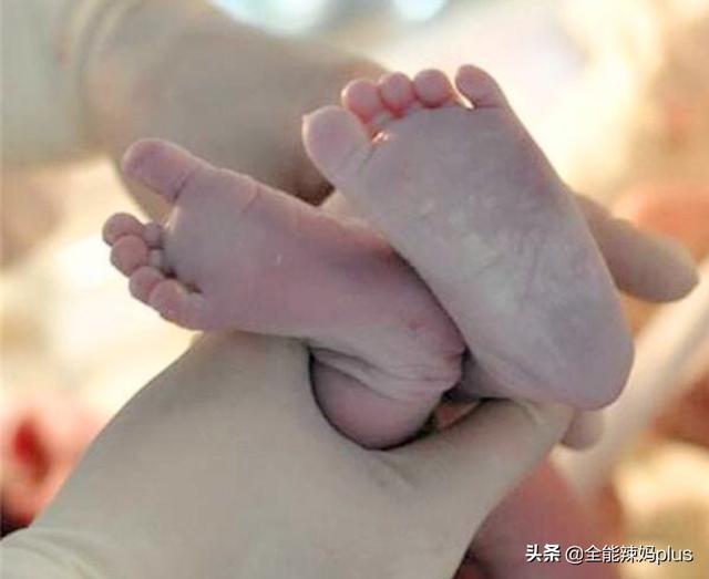 超级宝妈■新生儿全身“奶油”出生，宝爸看后吓得大哭，医生：偷着乐吧