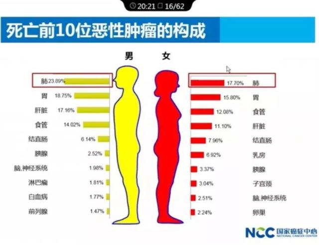 中山七院胸外科成功救治食管癌、肺癌双原发患者