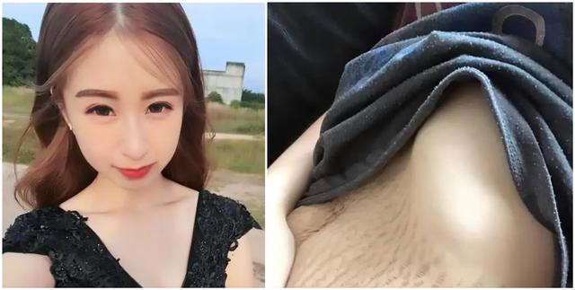 最爱笑的人|妊娠纹“勋章”—3种妈妈要注意，做到这两点，让“妊娠纹”走开