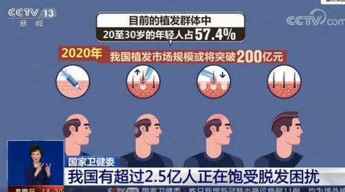 “秃”如起来的烦恼？2.5亿人的脱发，3个原因几乎占了一半