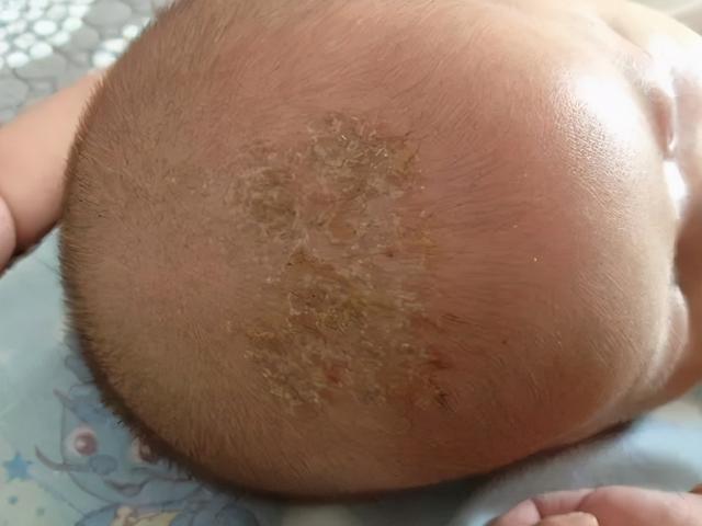 宝宝身上有4个“耐脏”部位，家长平时别勤洗，小心好心办坏事