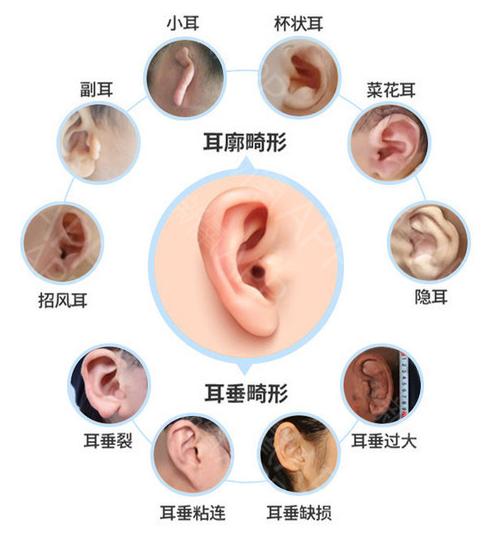 你的育儿经@新生儿患小耳畸形后，父母了解的这些，才能真正帮到孩子！