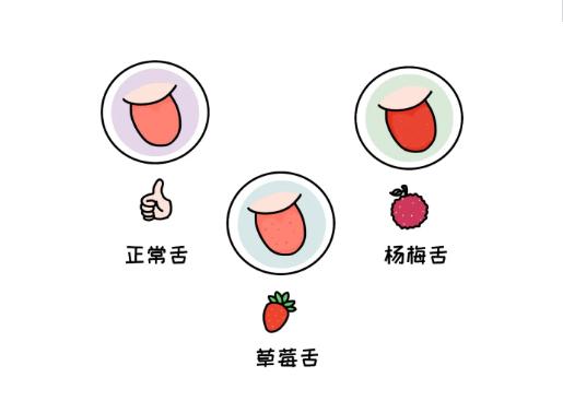 你的育儿经|看舌头，看健康！宝宝这4种常见舌象，都反映什么问题？