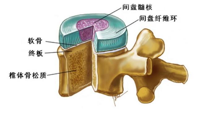 拿到片子不会看？6 种「椎间盘突出」的影像征象需注意