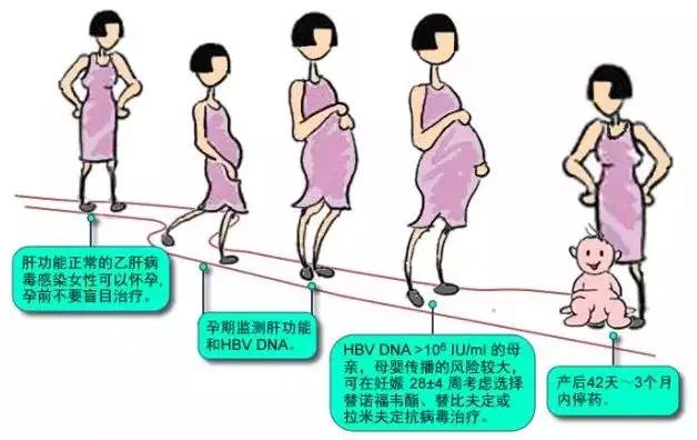 静静课堂■疑问：适龄乙肝女性备孕前，是否需要先服药抗病毒？