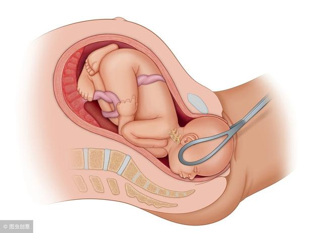 缩宫素|分娩之路不顺畅，助产手段知多少