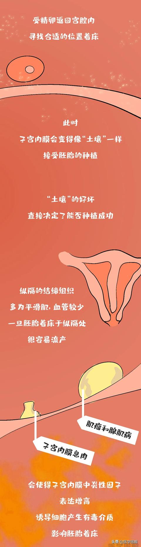 大眼睛的女孩|有这几种病，很难怀孕！就算试管婴儿，也可能失败丨医学图解