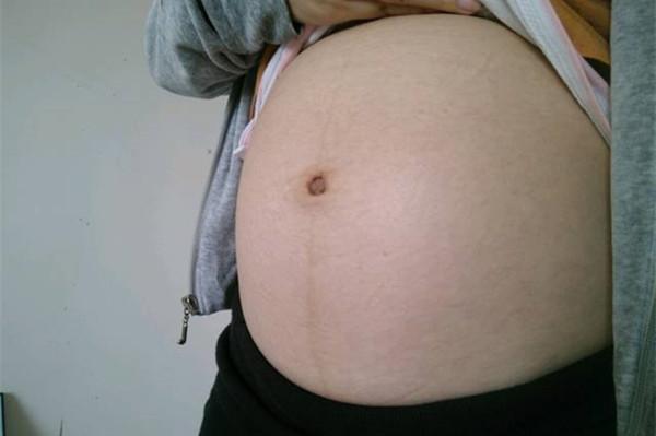 超级宝妈▲孕妈妈为什么会长妊娠纹？如何预防和缓解？快来学习吧