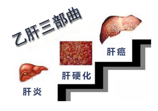 不小心喝了乙肝朋友的水，担心自己被感染，多久之后能检查出来？