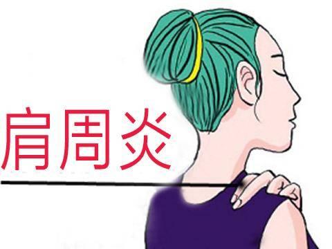 膝关节|女性容易得这几种骨科病，日常生活要注意这些问题