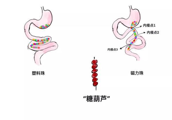 西安市儿童医院一年接诊多例患儿，都因这种孩子常玩的危险玩具！你家可能有