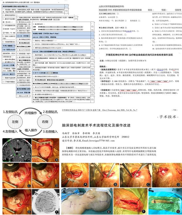 李卫国教授团队顺利开展DBS日间/加速康复外科手术治疗帕金森