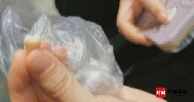 华西|坏牙不拔拔好牙？成都一女子找“华西特聘专家”拔牙出问题：系医生按照自身意愿拔牙