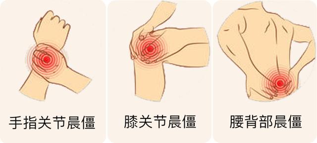 警惕|早起7个症状是疾病信号？一分钟教你“对症自查”