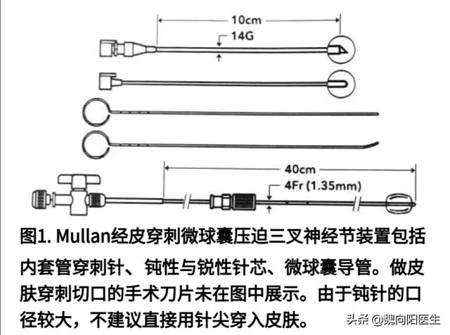 三叉神经痛难道只能吃止疼药吗？