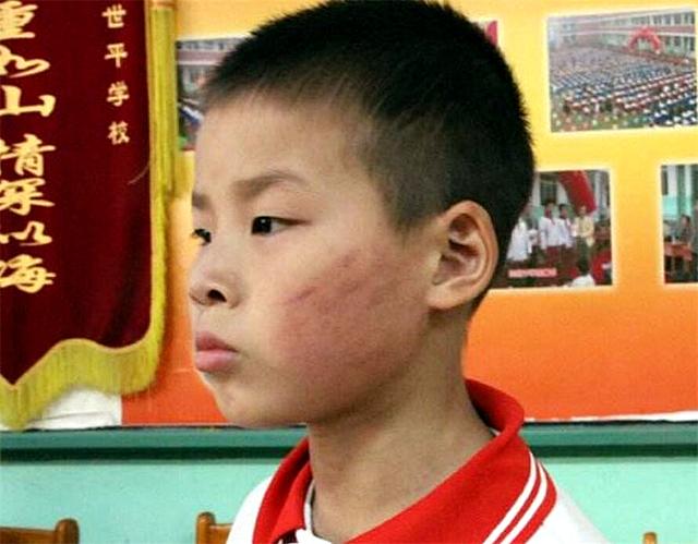 谈天说地|孩子在学校被欺负，家长别只会教“告诉老师”，李玫瑾支了一招