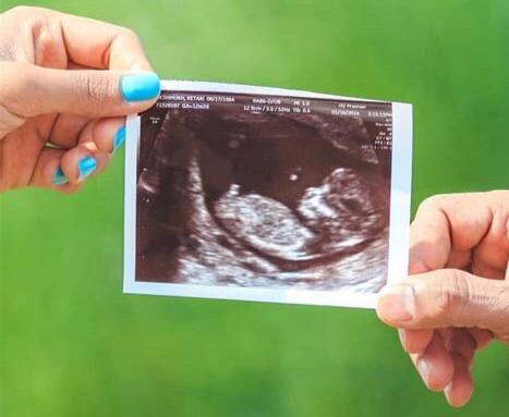 「你的育儿经」非常详细！送给新手妈妈最好的7次产检流程，请收藏